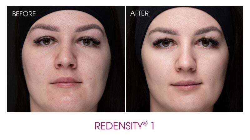 AES_INJ_R1_B&A 1 AES_INJ_R1_B&A 1