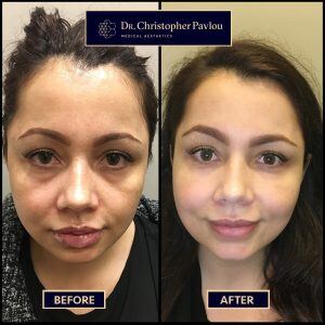 before-after-june19