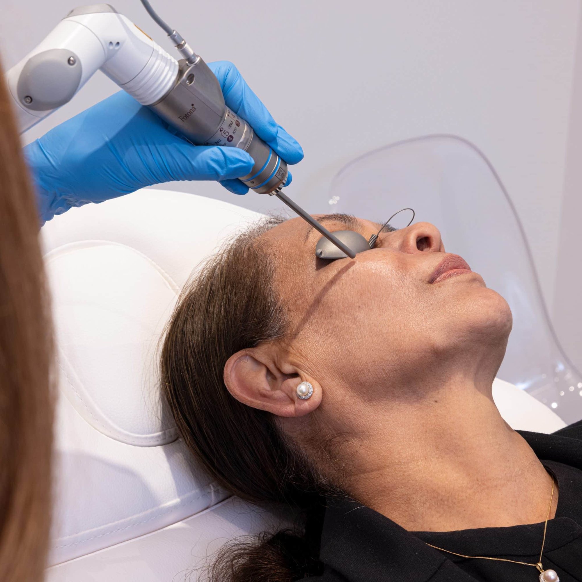 Technique for StarWalker Treatments Technique for StarWalker Treatments
