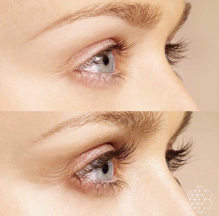 Sparse Lashes Treatment in Vancouver Sparse Lashes Treatment in Vancouver