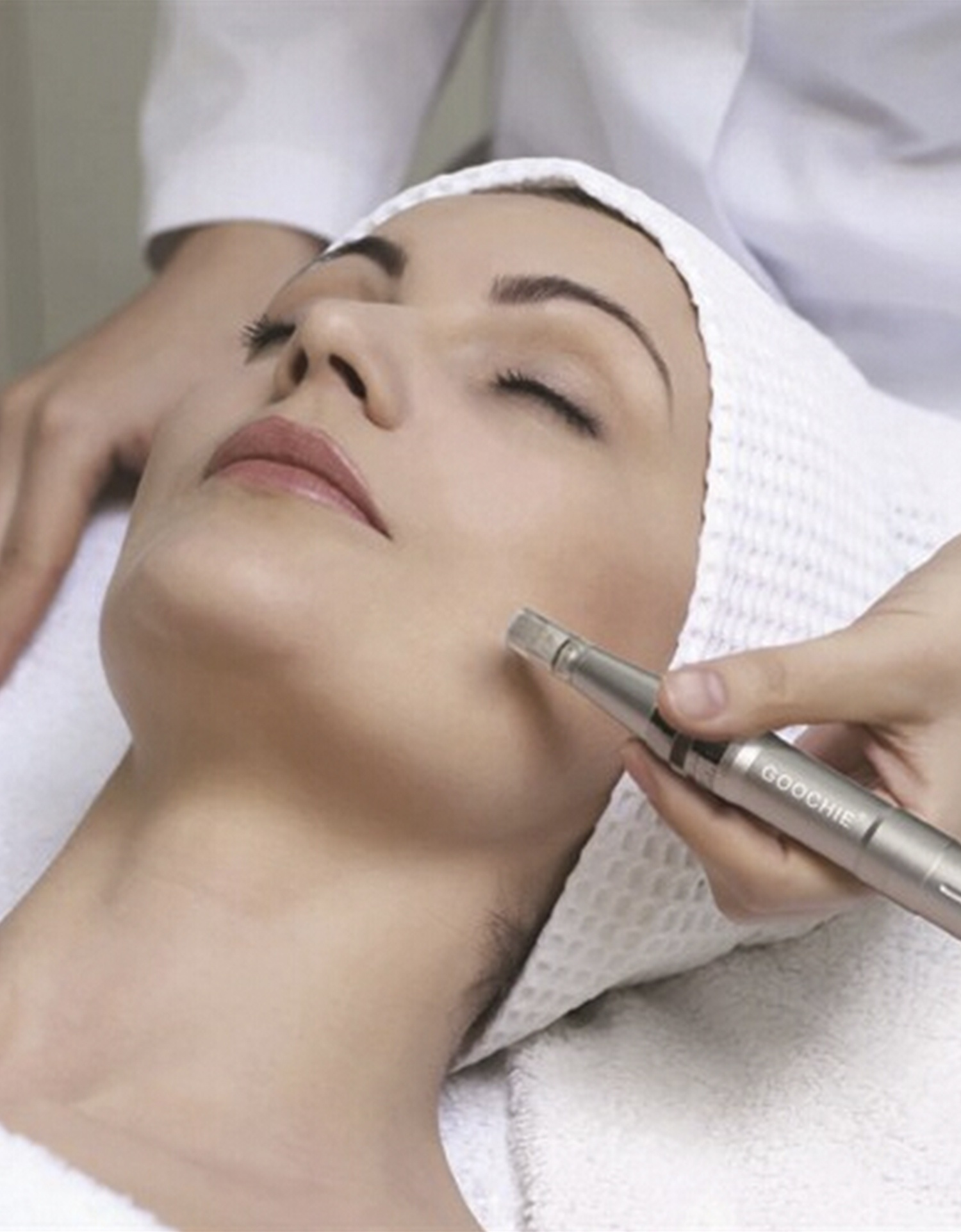 Micro-Needling Micro-Needling