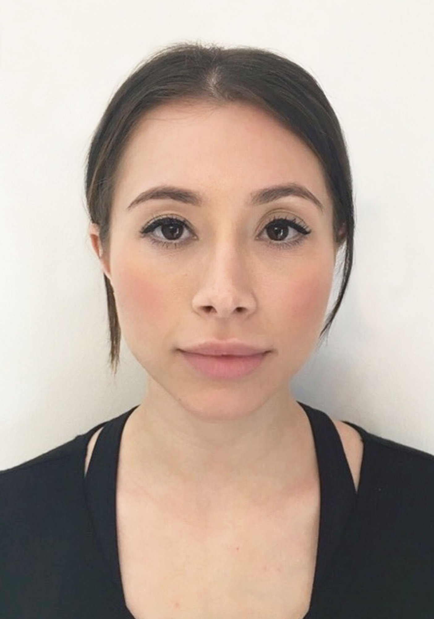 Facial Slimming