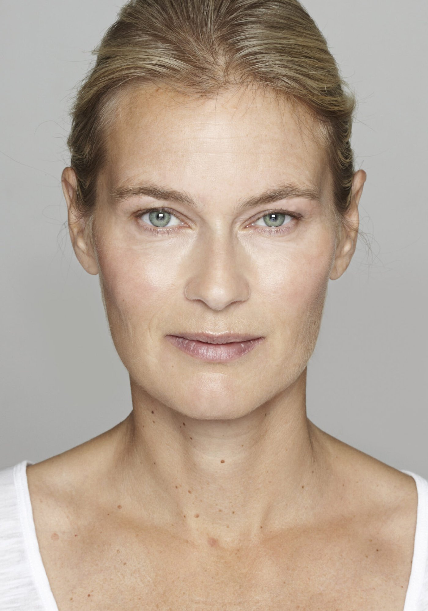 Skin Brightening After Skin Brightening After