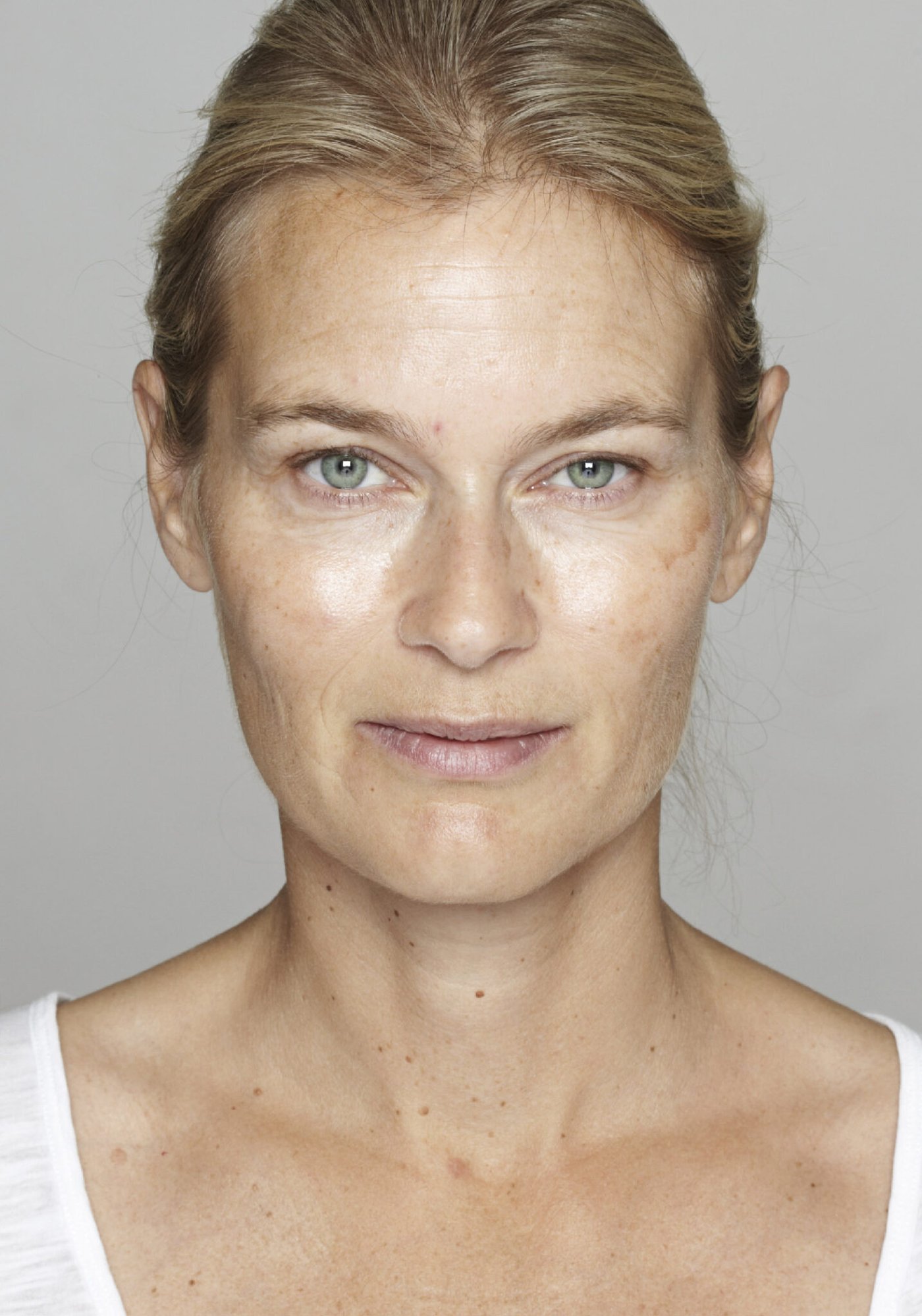 Skin Brightening Before Skin Brightening Before