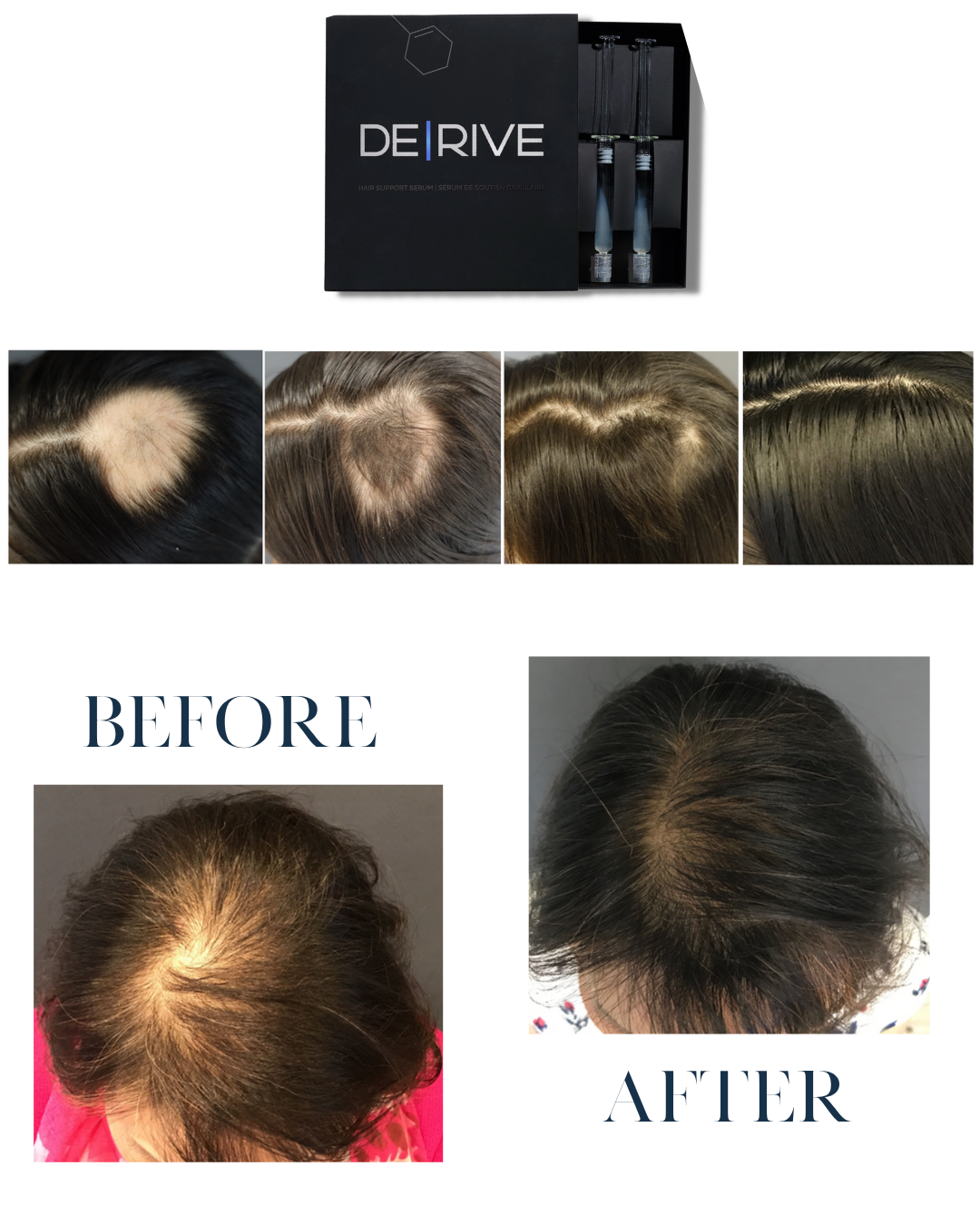Derive Hair Treatment