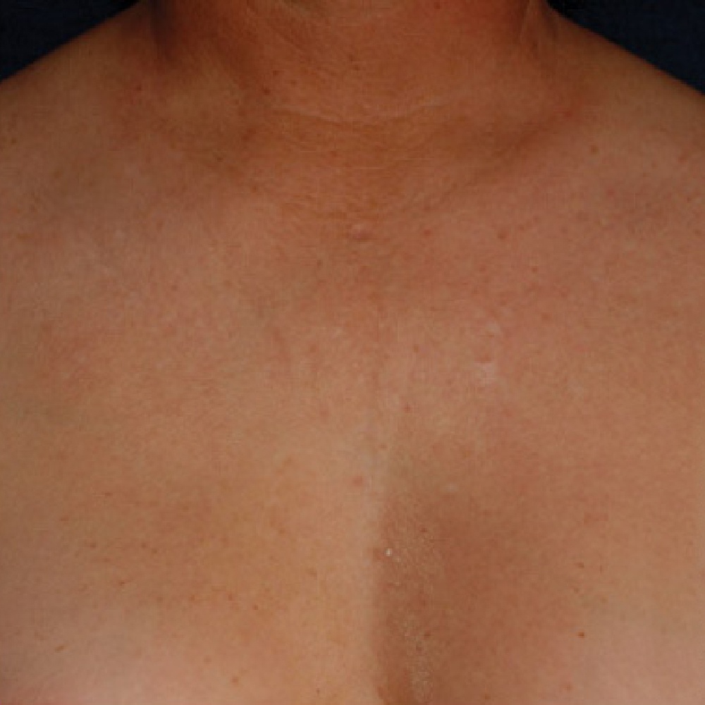 Décolletage Décolletage