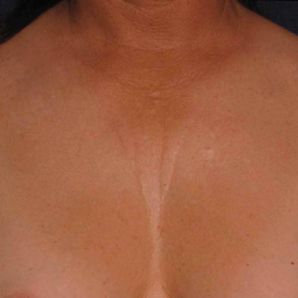 Décolletage Décolletage