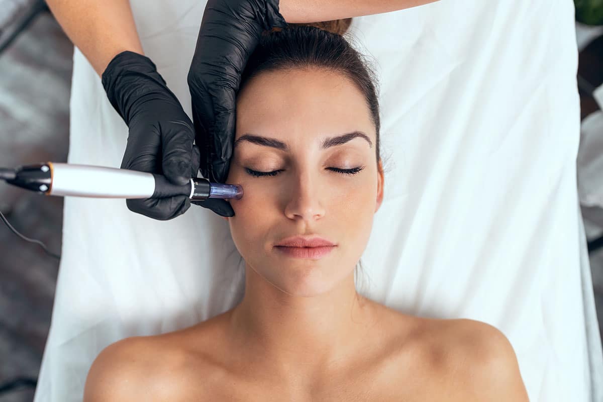 Woman receiving a microneedling treatment