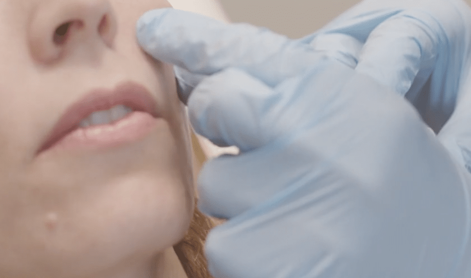 Non-Surgical Nose Job