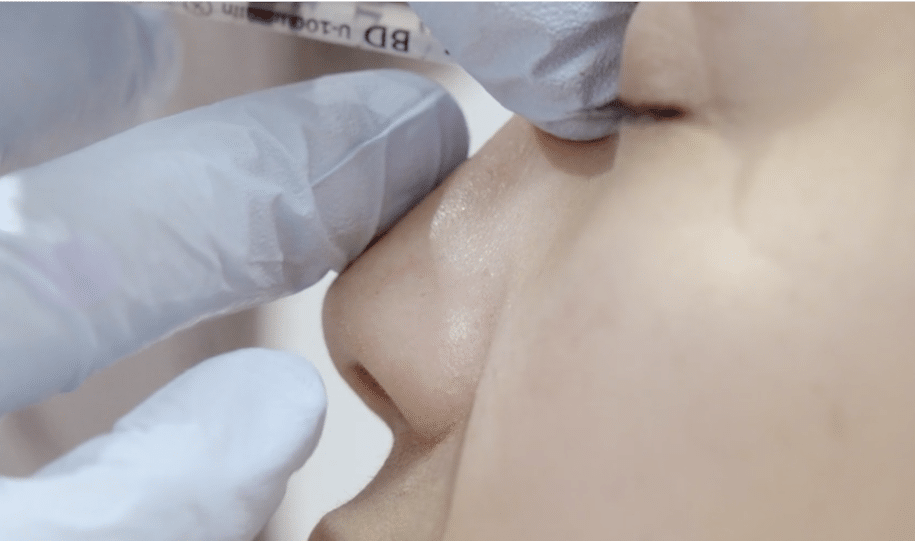 Non-Surgical Nose Job